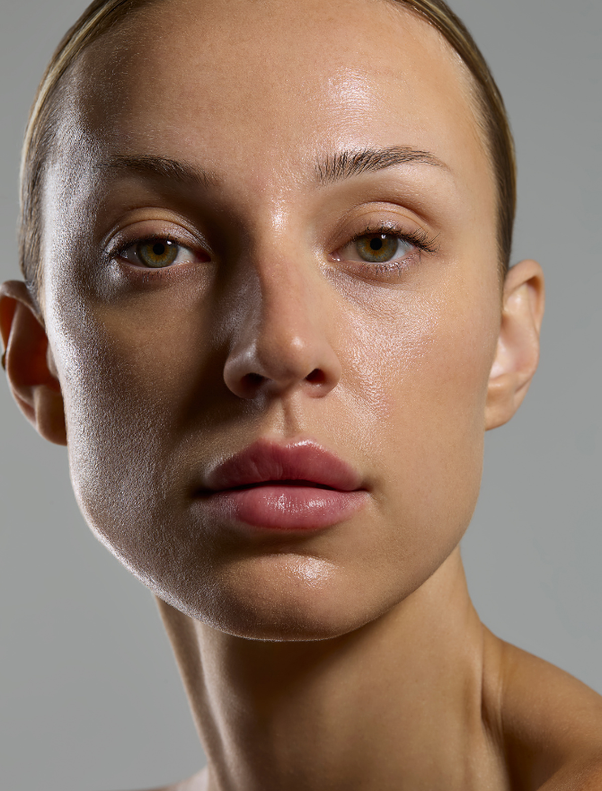 3 Ways Common PCOS Symptoms Impacting Your Skin, Hair And Overall Well-being
