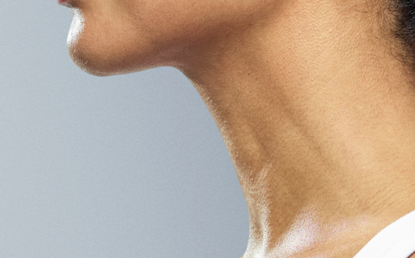 How to get rid of turkey neck: Natural neck tightening