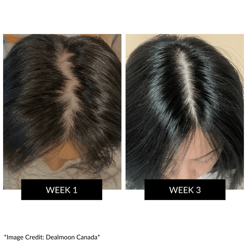 CurrentBody Skin LED Hair Regrowth Device - Affiliate Offer