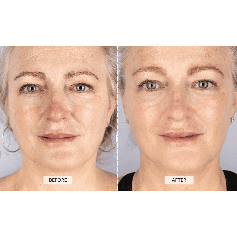 RETURNS - CurrentBody Skin Face & Neck Kit