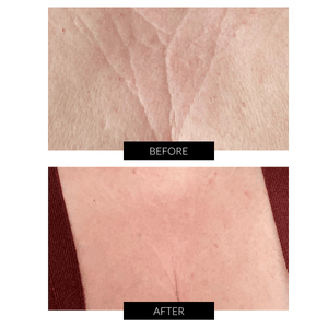 CurrentBody Skin LED Neck and Dec Perfector Offer