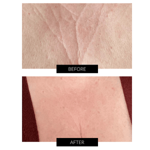 CurrentBody Skin LED Neck and Dec Perfector