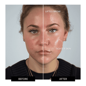 ZIIP HALO Facial Toning Device Offer