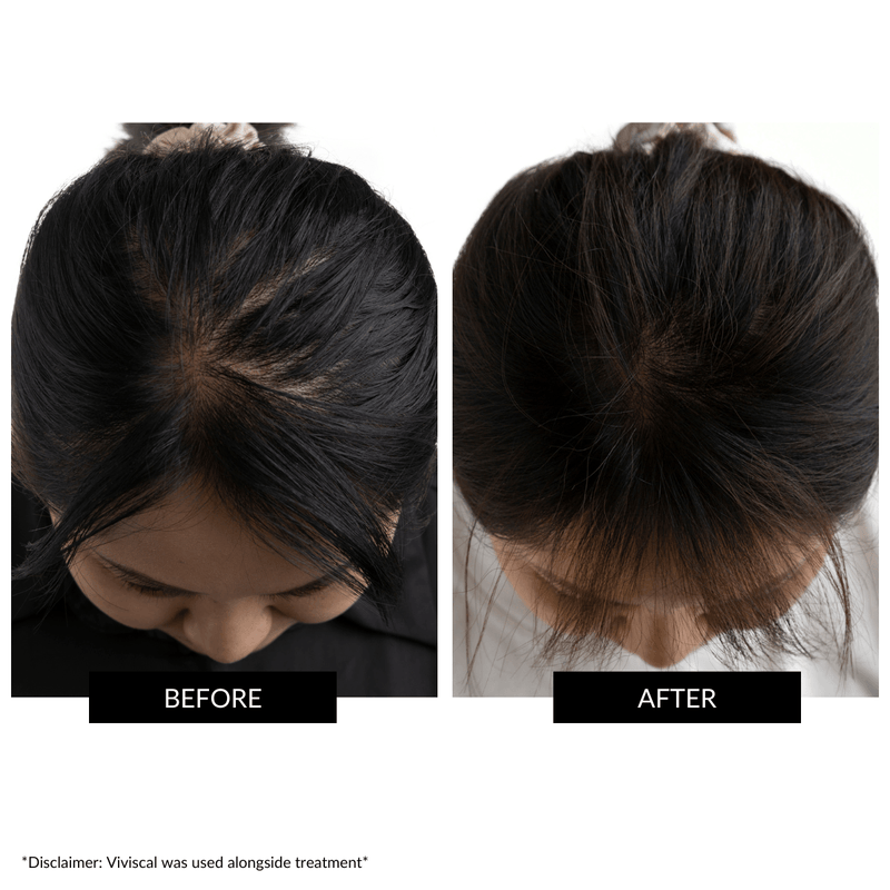 CurrentBody Skin LED Hair Regrowth Device - Affiliate Offer