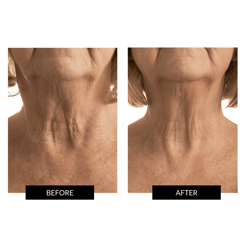 RETURNS - CurrentBody Skin Face & Neck Kit