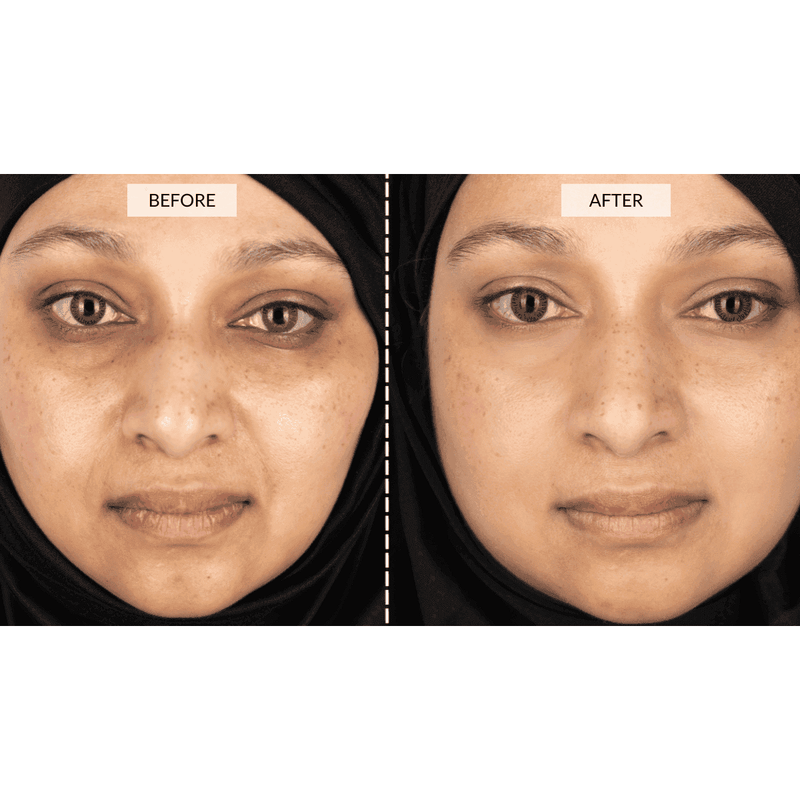 RETURNS - CurrentBody Skin Face & Neck Kit