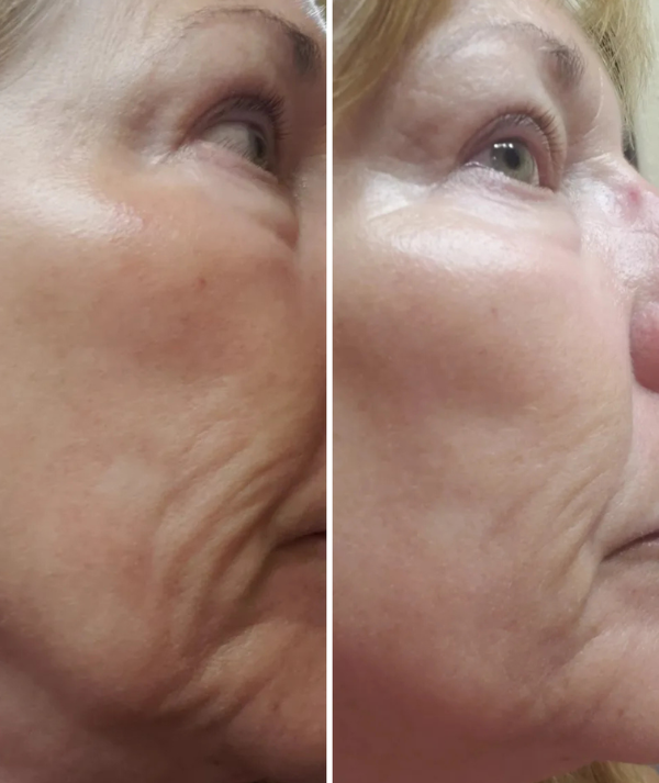 Anti-Ageing Products