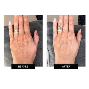 CurrentBody Skin LED Hand Perfector Offer