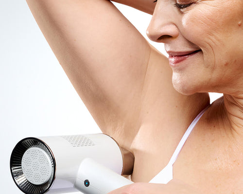 laser hair removal