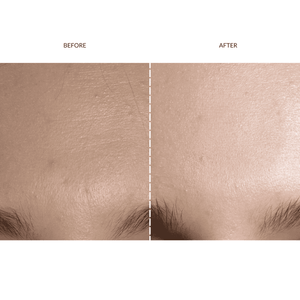 FAQ™ 202 Silicone Mask