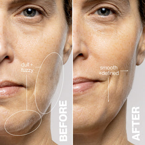 DERMAFLASH Luxe+ Anti-Ageing, Exfoliation + Peach Fuzz Removal Device