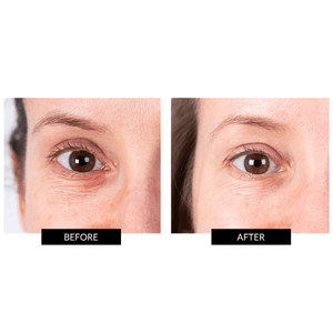 CurrentBody Skin LED Eye Perfector & 10 Eye Hydrogel Masks